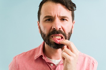 Man pulling down lower lip to reveal dark red gums