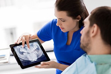Dentist discussing the cost of a root canal treatment in Naples